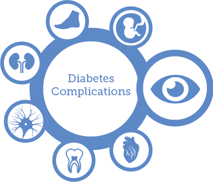 Komplikasi Diabetes